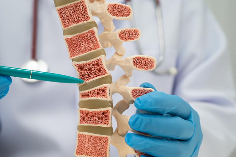 Osteoporosis